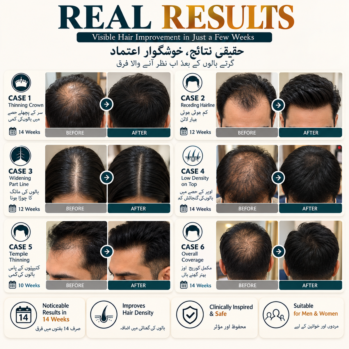FEG Plus hair growth results
